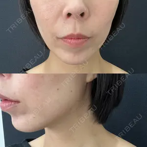 東京シンデレラ美容外科 東京シンデレラ美容外科 池袋院口コミ