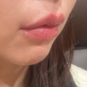 R Beauty CLINIC R Beauty CLINIC 銀座院口コミ