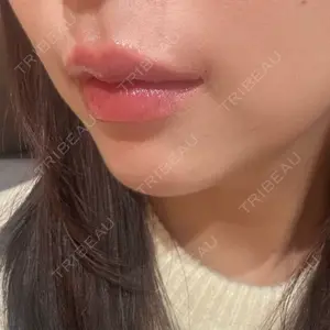 R Beauty CLINIC R Beauty CLINIC 銀座院口コミ