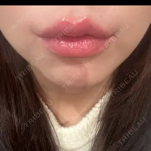 R Beauty CLINIC R Beauty CLINIC 銀座院口コミ