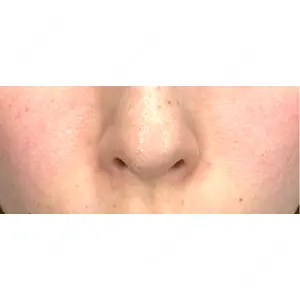 NARU Beauty Clinic NARU Beauty Clinic 【ナルクリ】 水戸院口コミ