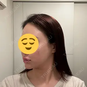 東京美容皮膚科アロエクリニック 東京美容皮膚科アロエクリニック池袋口コミ