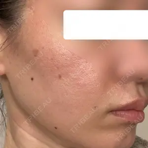 おおたかの森ビューティークリニック おおたかの森ビューティークリニック口コミ