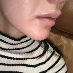 ビラビューティークリニック 博多美容外科/美容皮膚科 ビラビューティークリニック口コミ