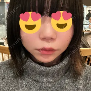 口コミ