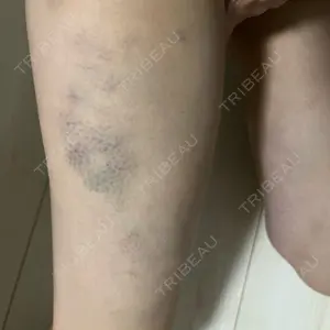 S.T styleクリニック口コミ