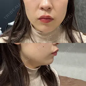 BiBiクリニック口コミ