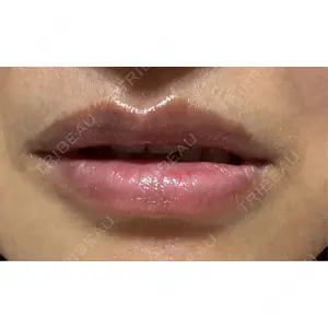 アネシス美容クリニック口コミ