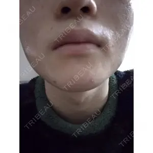 ルラ美容クリニック ルラ美容クリニック 札幌本院口コミ