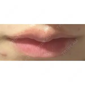 口コミ