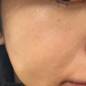 メディアージュクリニック メディアージュクリニック 大阪梅田院口コミ