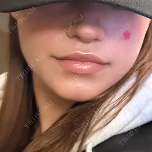 HAAB CLINIC HAAB BEAUTY CLINIC 名古屋院口コミ