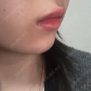 AZ BEAUTY CLINIC口コミ