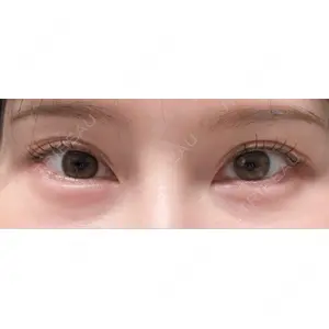 TCB東京中央美容外科 TCB東京中央美容外科 名古屋栄院口コミ