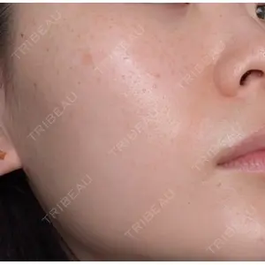 ルラ美容クリニック ルラ美容クリニック 池袋院口コミ