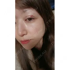 アイビークリニック 千葉美容外科アイビークリニック口コミ