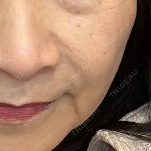 新宿ラクル美容外科クリニック 新宿院の