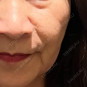 新宿ラクル美容外科クリニック 新宿院の