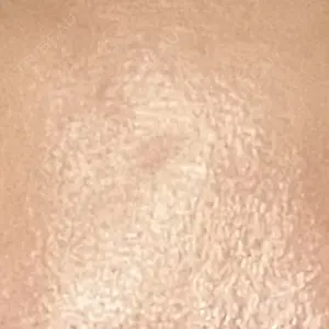 新宿駅三丁目クリニック口コミ