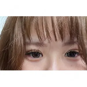 HAAB CLINIC HAAB BEAUTY CLINIC 名古屋院口コミ