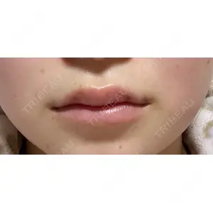 アイビークリニック 千葉美容外科アイビークリニック口コミ