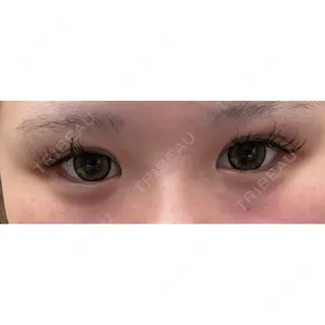 HAAB CLINIC HAAB BEAUTY CLINIC 名古屋院口コミ