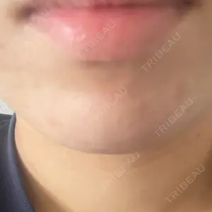 ルラ美容クリニック ルラ美容クリニック 福岡本院口コミ