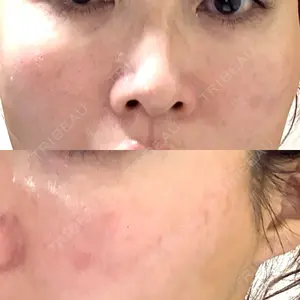 APスキンクリニック銀座口コミ