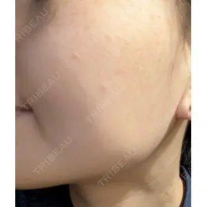 ルラ美容クリニック ルラ美容クリニック 池袋院口コミ