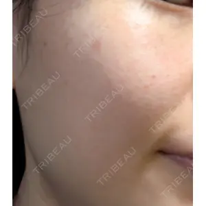 ルラ美容クリニック ルラ美容クリニック 池袋院口コミ