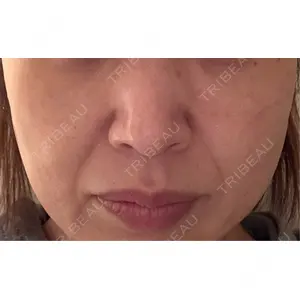 おおかみ美容のクリニック おおかみ美容のクリニック 横浜院口コミ