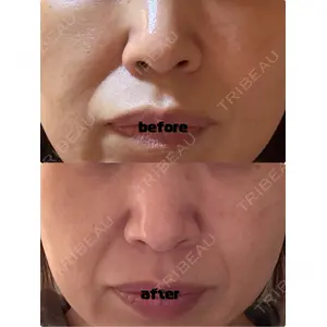 おおかみ美容のクリニック おおかみ美容のクリニック 横浜院口コミ