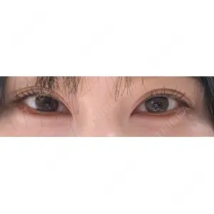 TCB東京中央美容外科 TCB東京中央美容外科 名古屋栄院口コミ