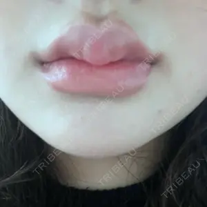 AZ BEAUTY CLINIC口コミ