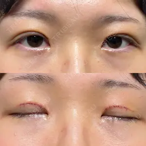 口コミ