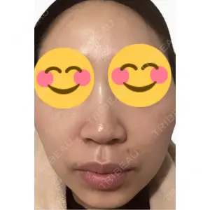 エルムクリニック 美容皮膚科エルムクリニック 麻布院口コミ