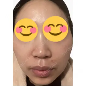 エルムクリニック 美容皮膚科エルムクリニック 麻布院口コミ