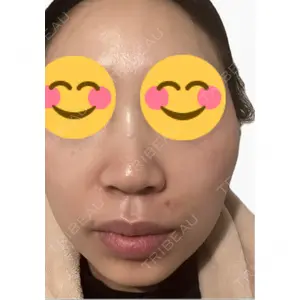 エルムクリニック 美容皮膚科エルムクリニック 麻布院口コミ