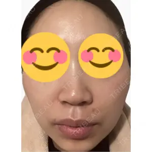 エルムクリニック 美容皮膚科エルムクリニック 麻布院口コミ