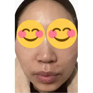 エルムクリニック 美容皮膚科エルムクリニック 麻布院口コミ