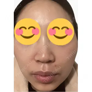 エルムクリニック 美容皮膚科エルムクリニック 麻布院口コミ