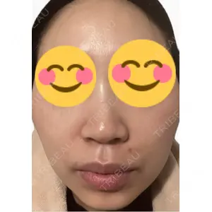 エルムクリニック 美容皮膚科エルムクリニック 麻布院口コミ