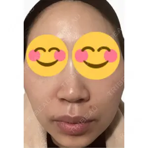 エルムクリニック 美容皮膚科エルムクリニック 麻布院口コミ