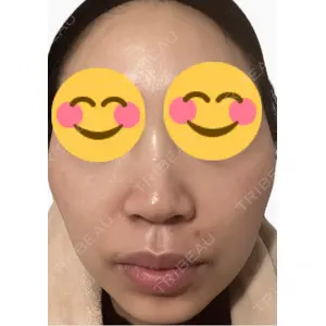 エルムクリニック 美容皮膚科エルムクリニック 麻布院口コミ