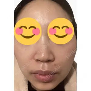 エルムクリニック 美容皮膚科エルムクリニック 麻布院口コミ