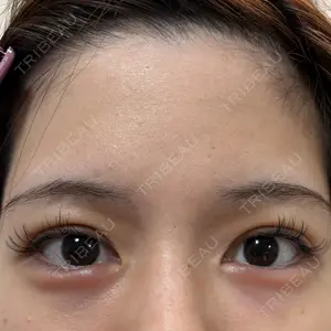 ビラビューティークリニック 博多美容外科/美容皮膚科 ビラビューティークリニック口コミ