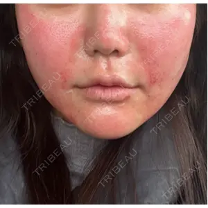 TCB東京中央美容外科 TCB東京中央美容外科 名古屋栄院口コミ