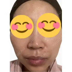 エルムクリニック 美容皮膚科エルムクリニック 麻布院口コミ