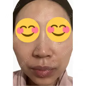 エルムクリニック 美容皮膚科エルムクリニック 麻布院口コミ