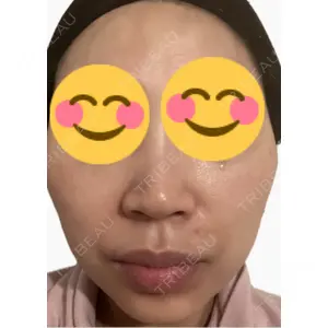 エルムクリニック 美容皮膚科エルムクリニック 麻布院口コミ